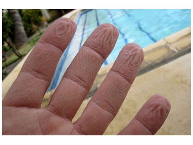 Porque se nos arrugan las manos al durar mucho tiempo en el agua?